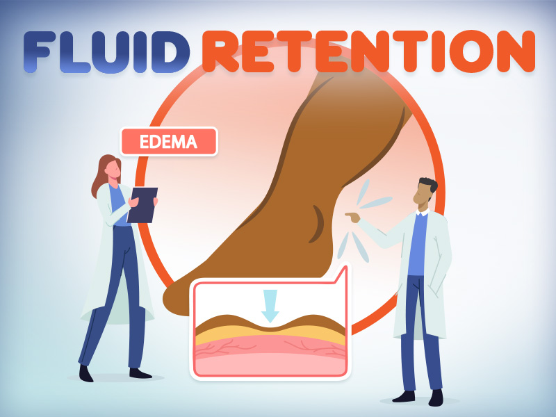 Edema: When is swelling a sign of something more serious?